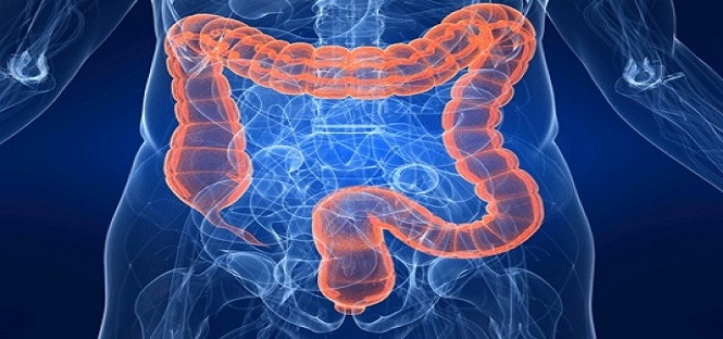 Studio dell’Università di Milano-Bicocca sul tumore del colon: individuato il gene che impedisce la sua cura